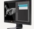 3DISC - Radiography System | QuantorVet+ Imaging Software