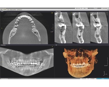 Dexis - Dental 3D Imaging System | OP 3D PRO 