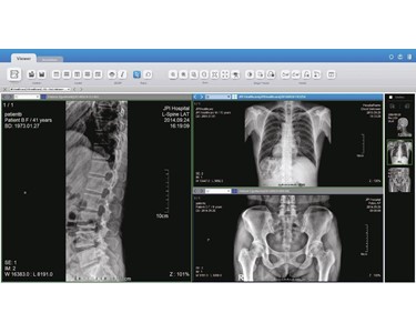 Imex - X-Ray Machine | For Chiropractor Use
