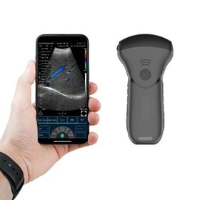 C10MT-Pro USB&Wifi Convex Abdominal Hand-Held Ultrasound