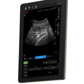 Veterinary Ultrasound Machine | ACUSON Maple | PILOTER