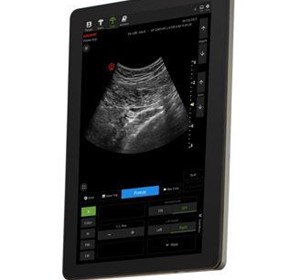 Veterinary Ultrasound Machine | ACUSON Maple | PILOTER