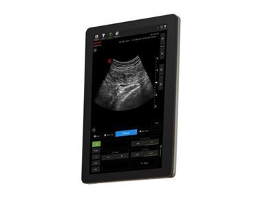 Wisonic - Veterinary Ultrasound Machine | ACUSON Maple | PILOTER