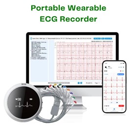 Portable Wearable ECG Recorder