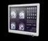 Onyx - 17" Fanless Slim Medical All In One PC | SMA-1733