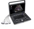 SonoScape - E2 Premium Colour Doppler Portable Ultrasound Scanner