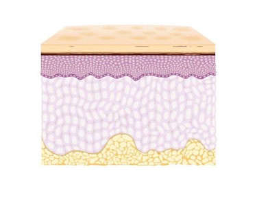 Deka - CO2 Fractional Laser PSD Technology | Tetra PRO