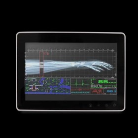 10.1" Fanless Slim Medical All In One PC | SMA-1033