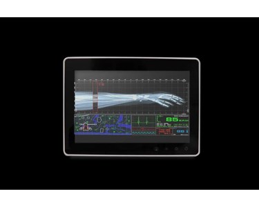 Onyx - 10.1" Fanless Slim Medical All In One PC | SMA-1033
