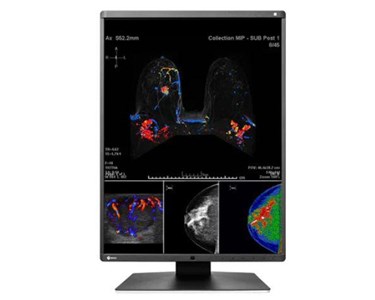 Eizo - 5MP Colour Diagnostic Monitor | RadiForce RX560 Dual Monitor Setup