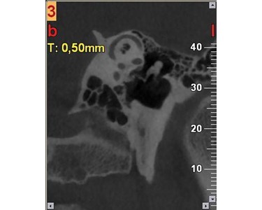 NewTom - VGi EVO 2D/3D CBCT X-ray 