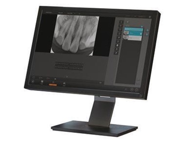 Imex - CR Dental Imaging Plate Reader For X-ray