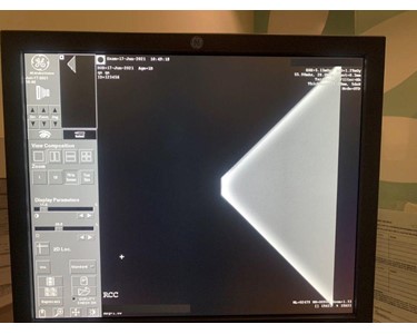 GE - Seno DS Digital [Mammography System] [EX2381]