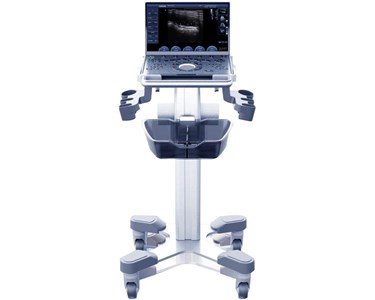 Chison - SonoAir 70 Ultrasound