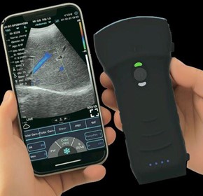 C10MT-Pro USB&Wifi Convex Abdominal Hand-Held Ultrasound