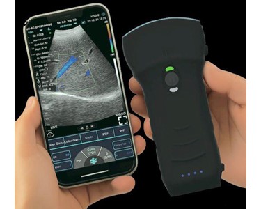 C10MT-Pro USB&Wifi Convex Abdominal Hand-Held Ultrasound
