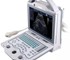 Full Digital Hand Held Ultrasound Scanner | KX5600v