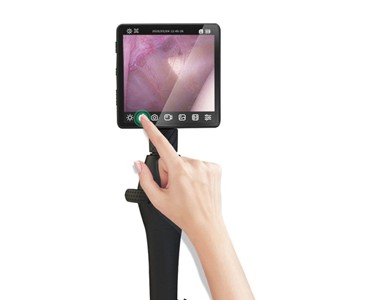Yateks - Handheld Veterinary Video Endoscope | V Series