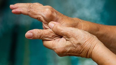 Metacarpal Head Cartilage Damage in Rheumatoid Arthritis