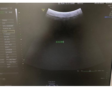 GE - 4C-RS [Ultrasound Transducer ] [EX2388]