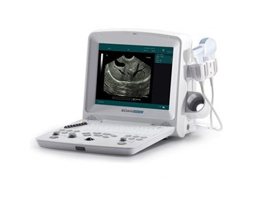 Edan - Vet Ultrasound System | DUS60 