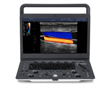 SonoScape - E2V Veterinary Colour Doppler Portable Ultrasound Machine Scanner