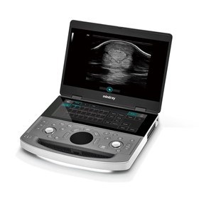  Portable Veterinary Ultrasound Machine | Vetus EQ