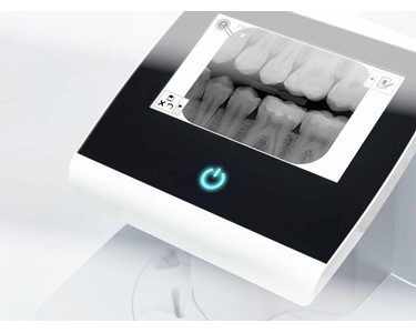 Durr Dental - Dental Scanner | Ultra View