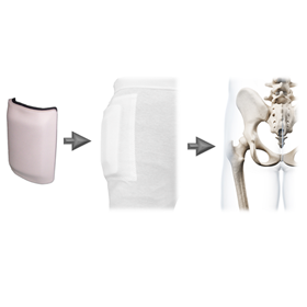 Homecare & Consumer Medical | Hip Protector Pads & Pants