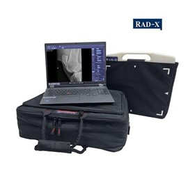 RAD-X DR X1A Rover Portable DR System