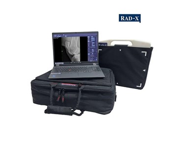 Radincon - RAD-X DR X1A Rover Portable DR System