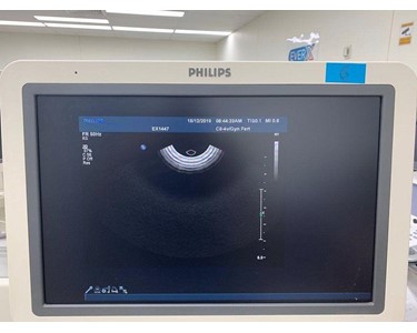 Philips - Ultrasound Machine | IU 22 Cart G.1 -(EX1447)