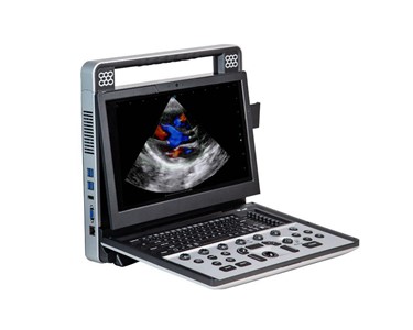 Siui - Portable Ultrasound Machine | Apogee C5  