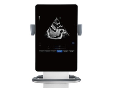 Mindray - Diagnostic Ultrasound System TE9