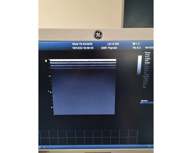 GE -  Vivid T8 Ultrasound Machine - (EX3076)