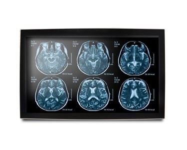 Onyx - 23.8” Slim Medical Display | MEDDP-624