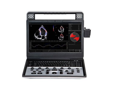 Siui - Portable Ultrasound Machine | Apogee C5  