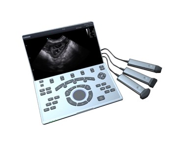 Chison - SonoAir 70 Ultrasound