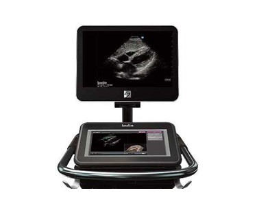 Ultrasound System | ARIETTA 750 DeepInsight