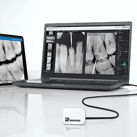 Intraoral Digital X-Ray Sensor | SensorX 