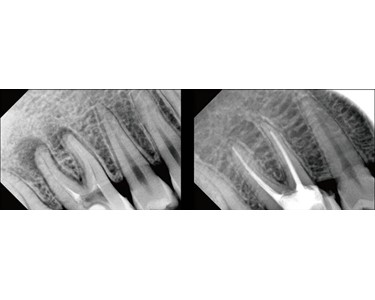 Portable Dental X-Ray Camera | Le Ray P
