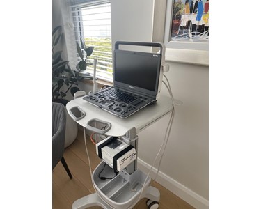 SonoScape - Portable Ultrasound Machine | E3 Premium