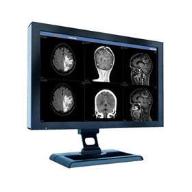 2D Imaging Systems | Anatomical Linking