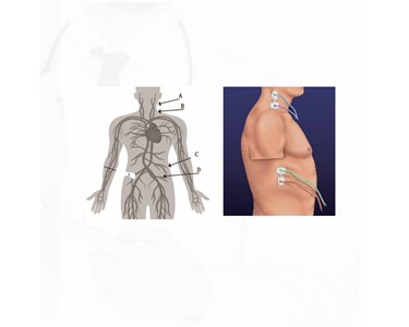 APS Technology Australia - Multi-parameter ICG Module – Non-invasive Hemodynamic Monitoring Syste