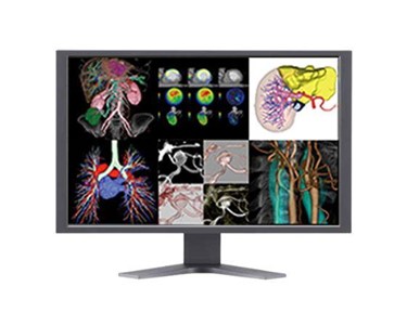 Fujifilm - Healthcare IT | Synapse® 3D CV