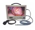 All-in-One Medical Portable Video Endoscopic System (AE-1080 HD)
