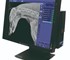 Radincon -  Veterinary X-Ray System | RAD-X DR CX3A Mobile System