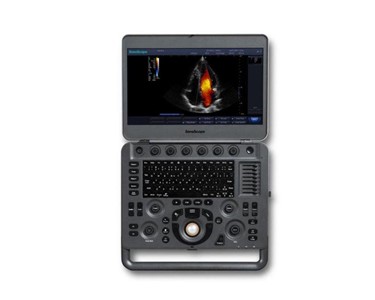 X3 Colour Doppler Portable Ultrasound Machine