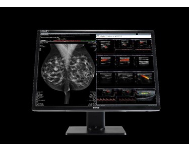 Barco - Diagnostic Displays