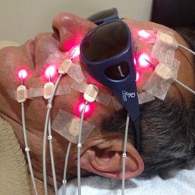 Light Needle Acupuncture Laser Photobiomodulation Therapy